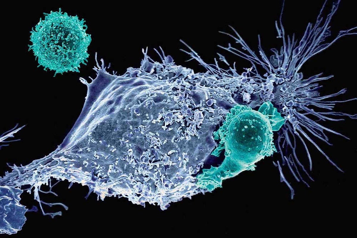 crispr cancer treatment t cells