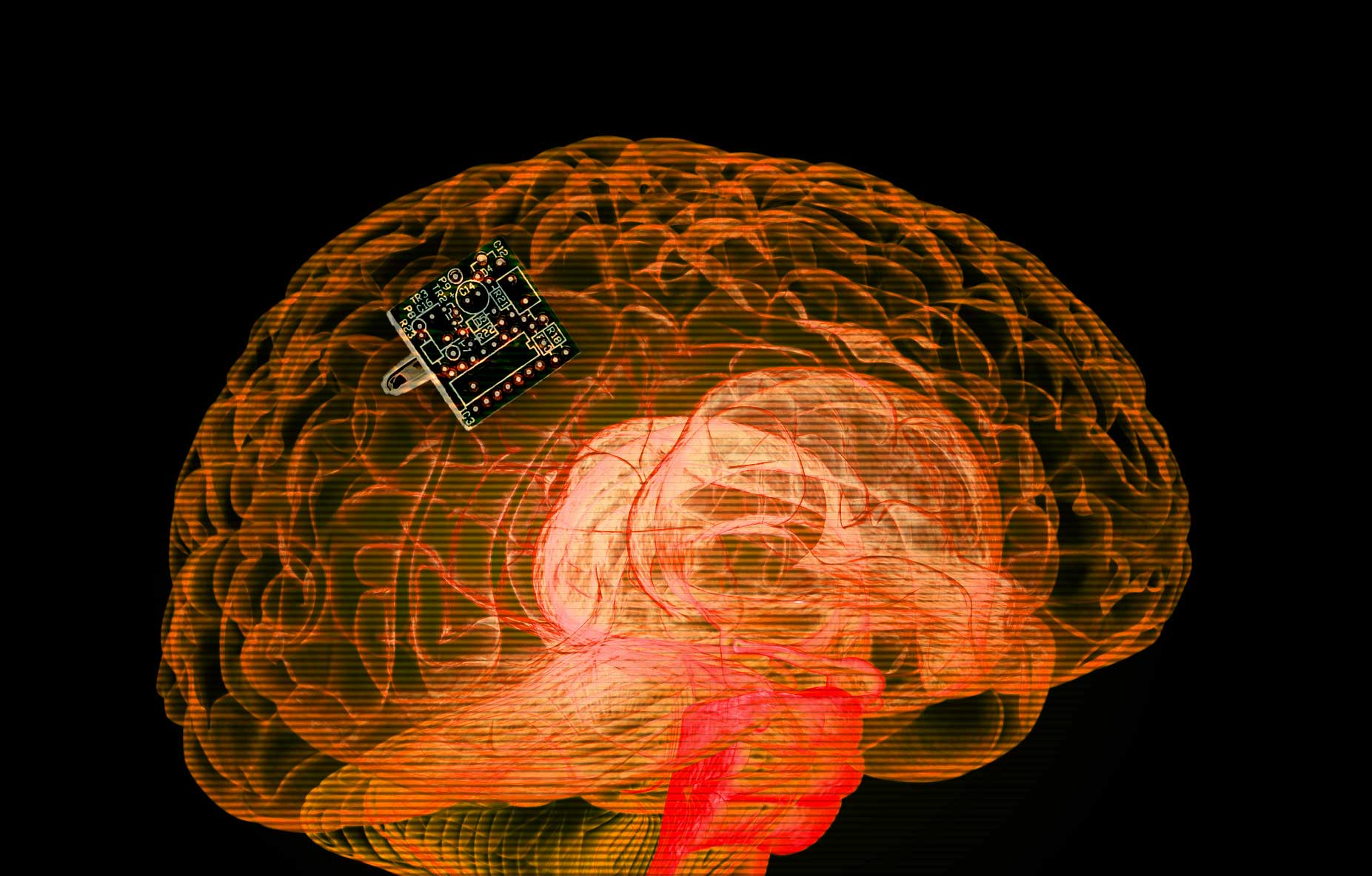 bci neuralink eeg medical tech