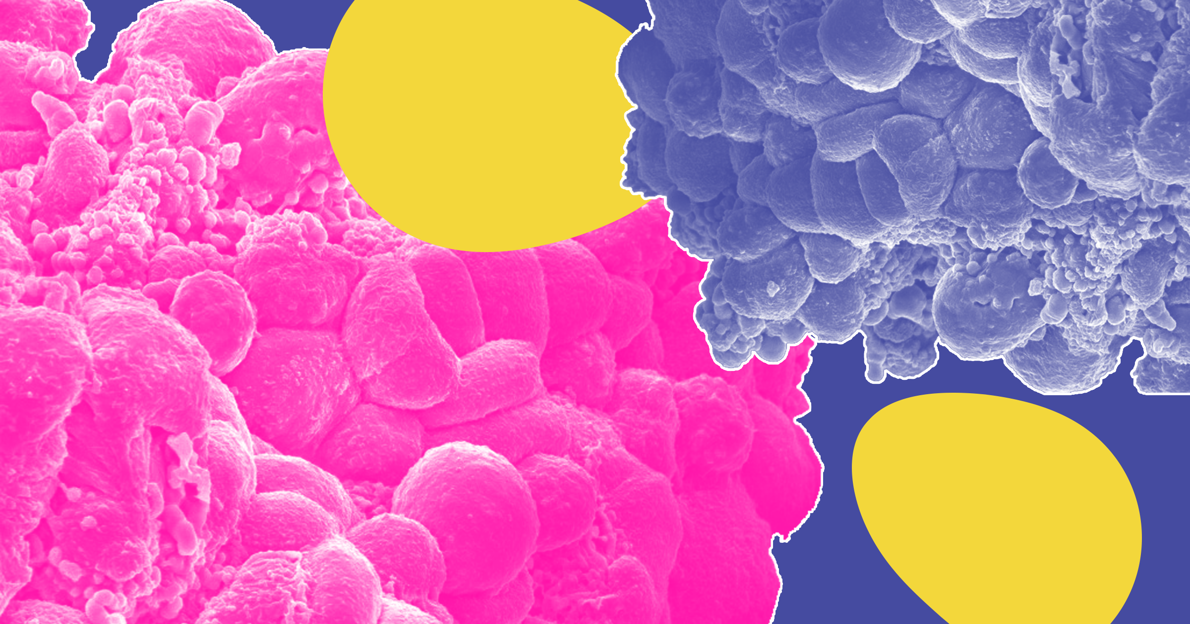 cancer prevention cancer causes magical cures