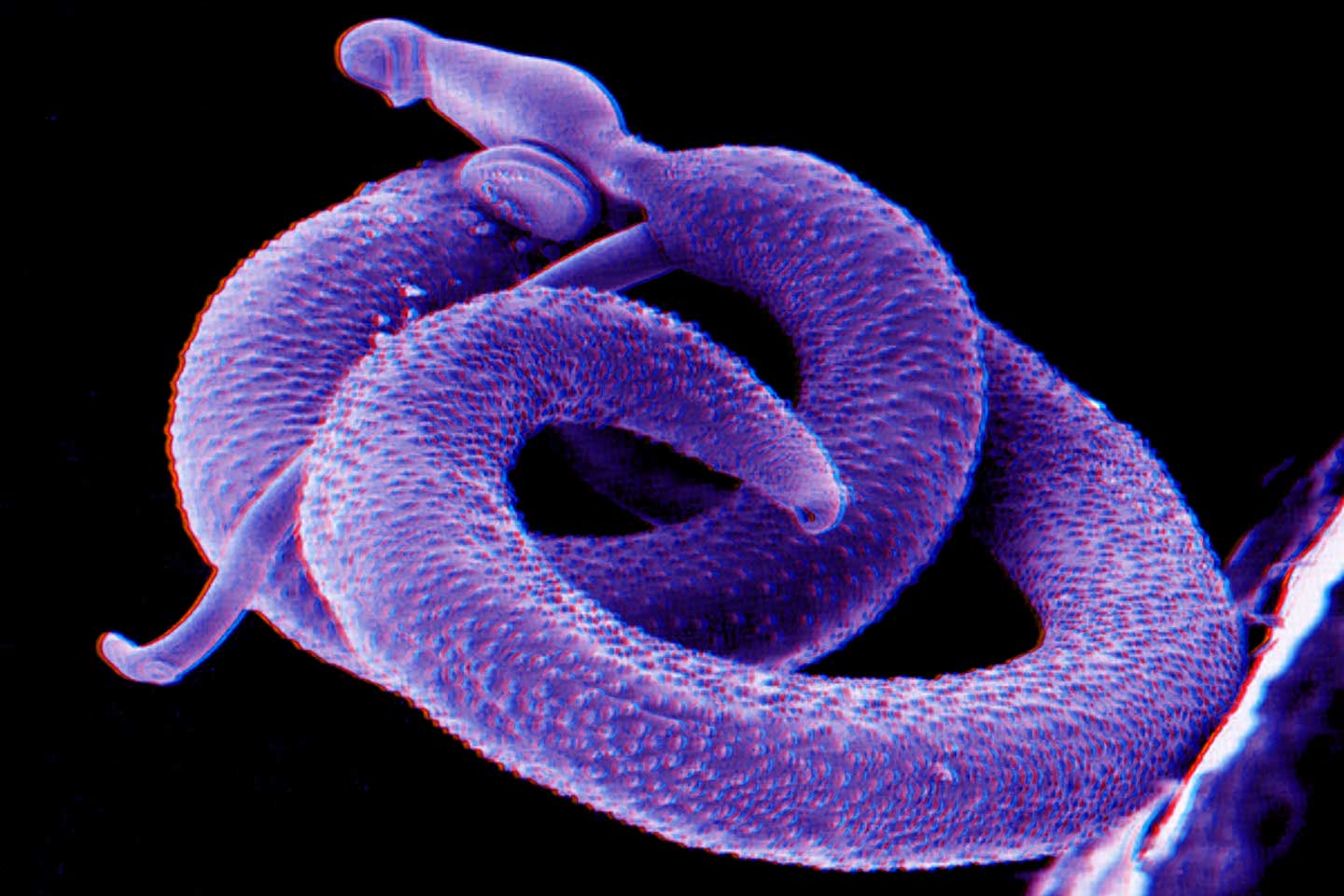 schistosomiasis parasites parasitic worm