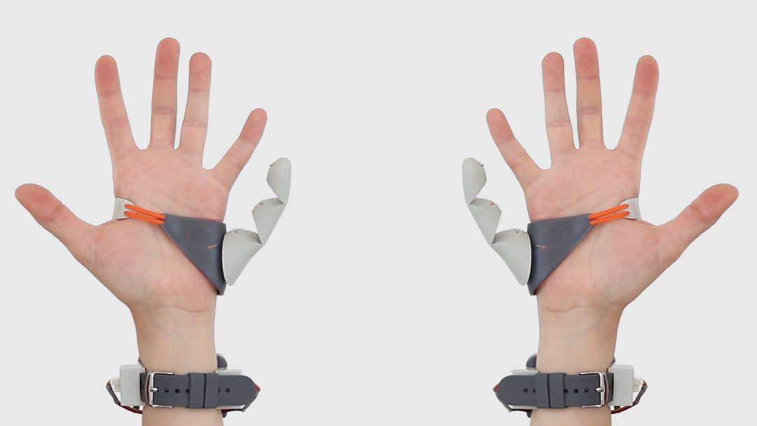 Two hands each with an extra thumb augmentation.