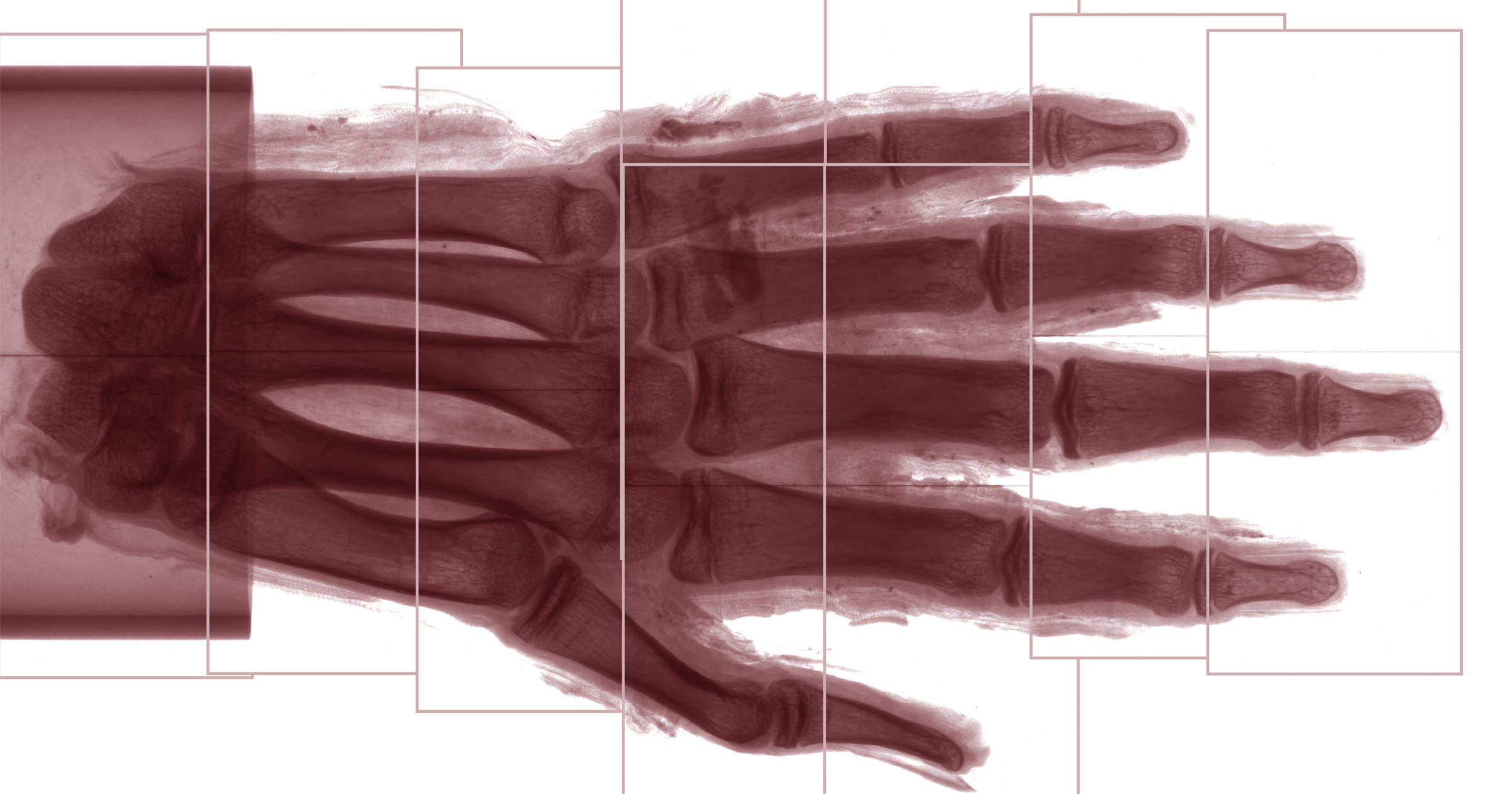 A new technique described in the journal Radiology gives them the most detailed images of long-dead people yet — down to the cellular level.