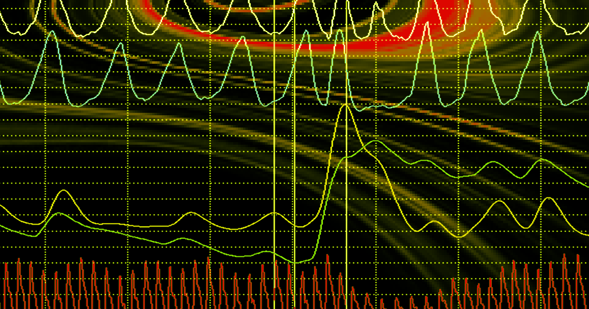 Spain is rolling out an AI lie detector called VeriPol at many of its police stations, which uses machine learning to flag false police reports.