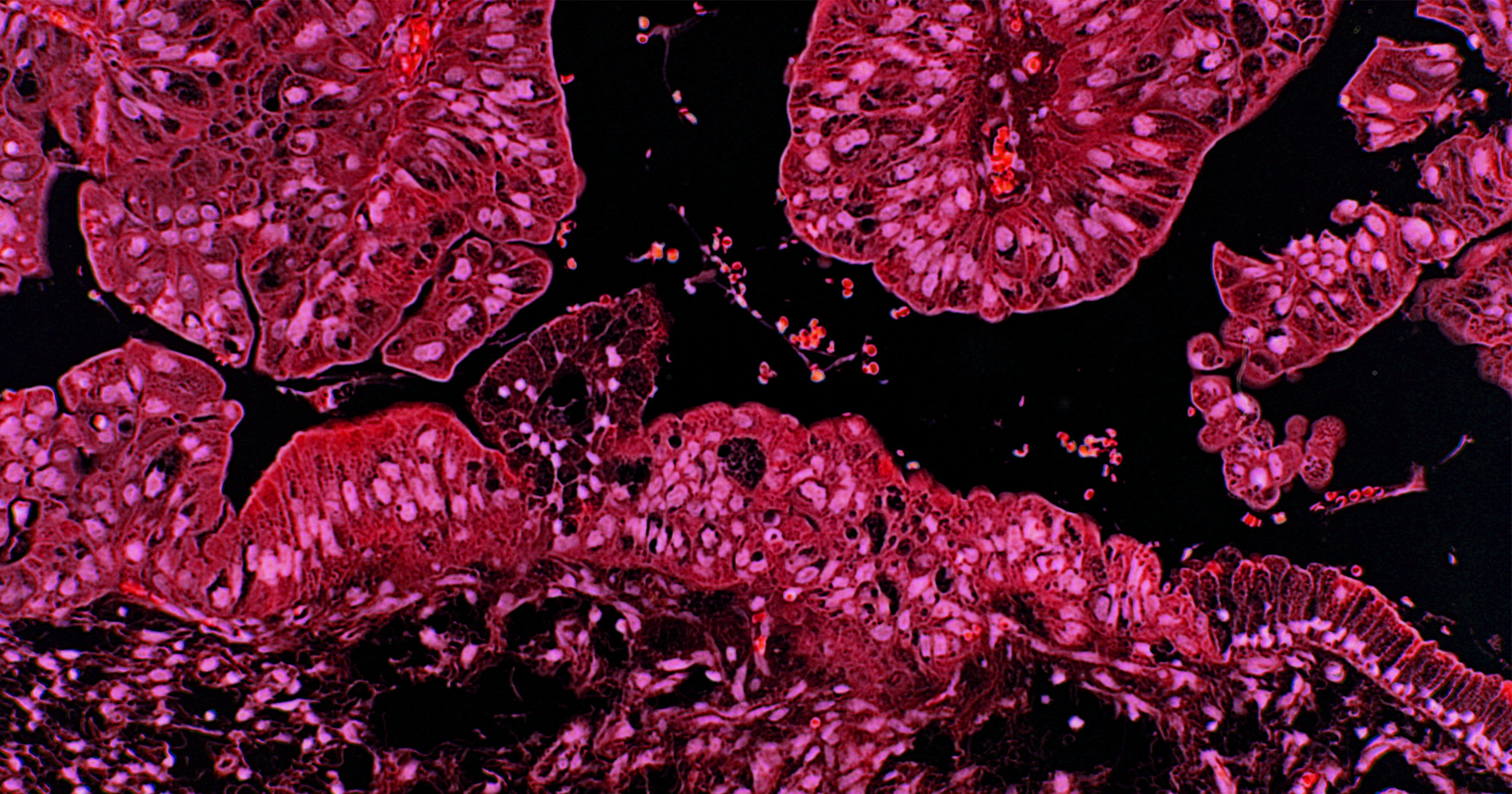 Australia is on track to all but eliminate cervical cancer within its borders by 2066, and the U.S. could follow in its footsteps.
