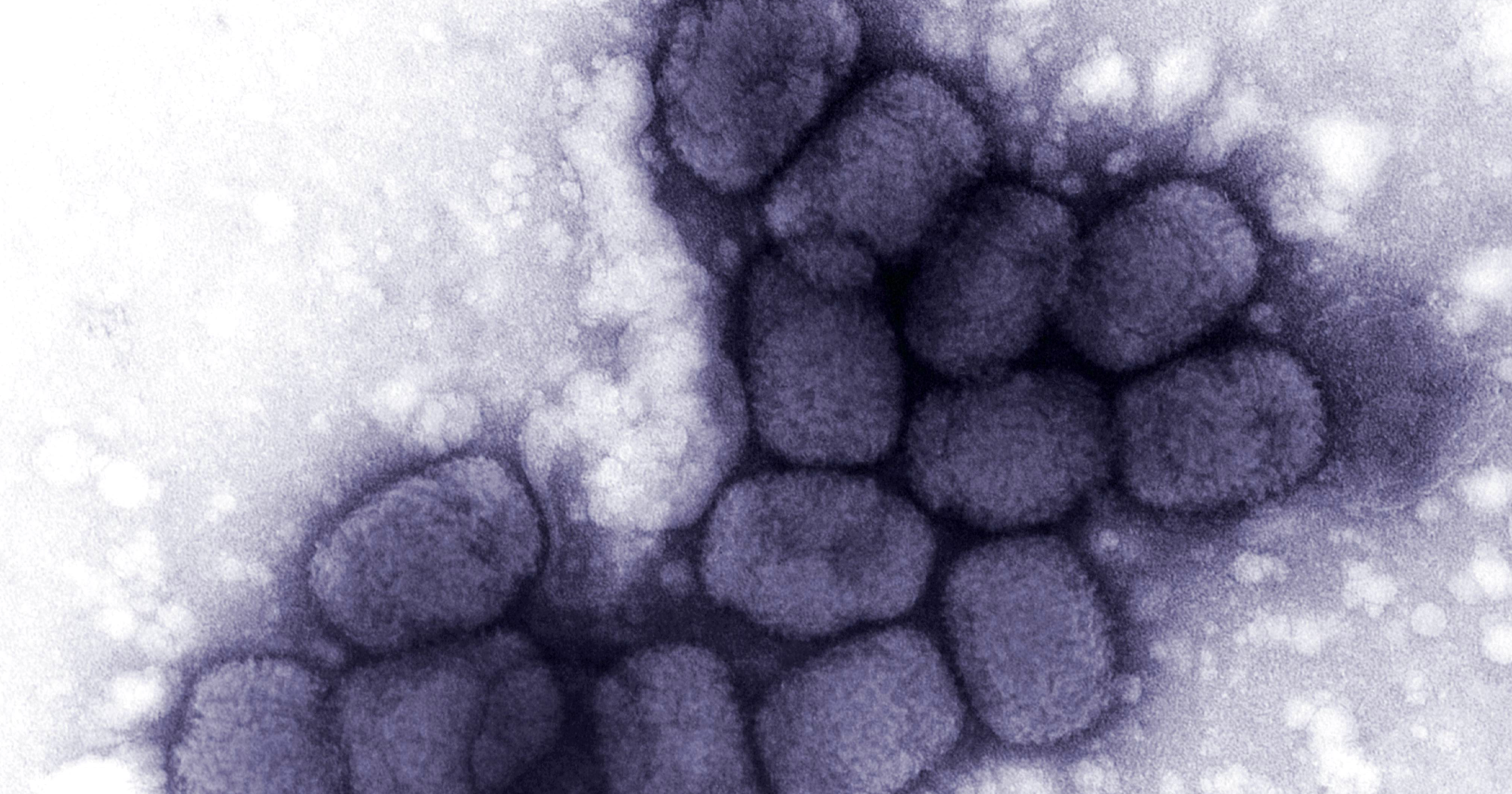 Scientists are arguing about whether you be allowed to publish a paper that could be used to bring back a virus that could cause a deadly pandemic.