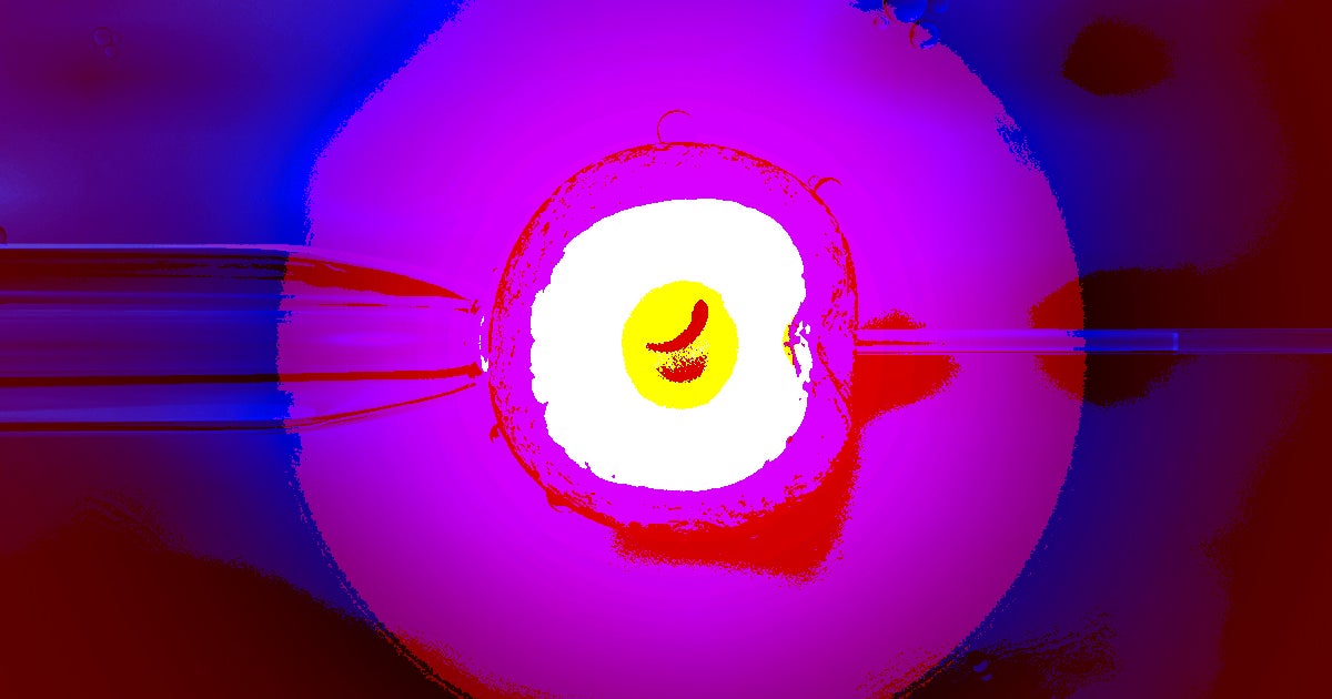 A biotechnology firm figured out how to scan an embryo for genetic markers that predict an abnormally high or low intelligence.