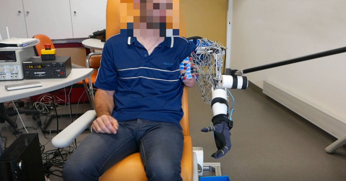 A new robotic limb picks up on the signals that an amputee's brain sends to their perceived phantom limbs. Without any practice, the new arm responds.