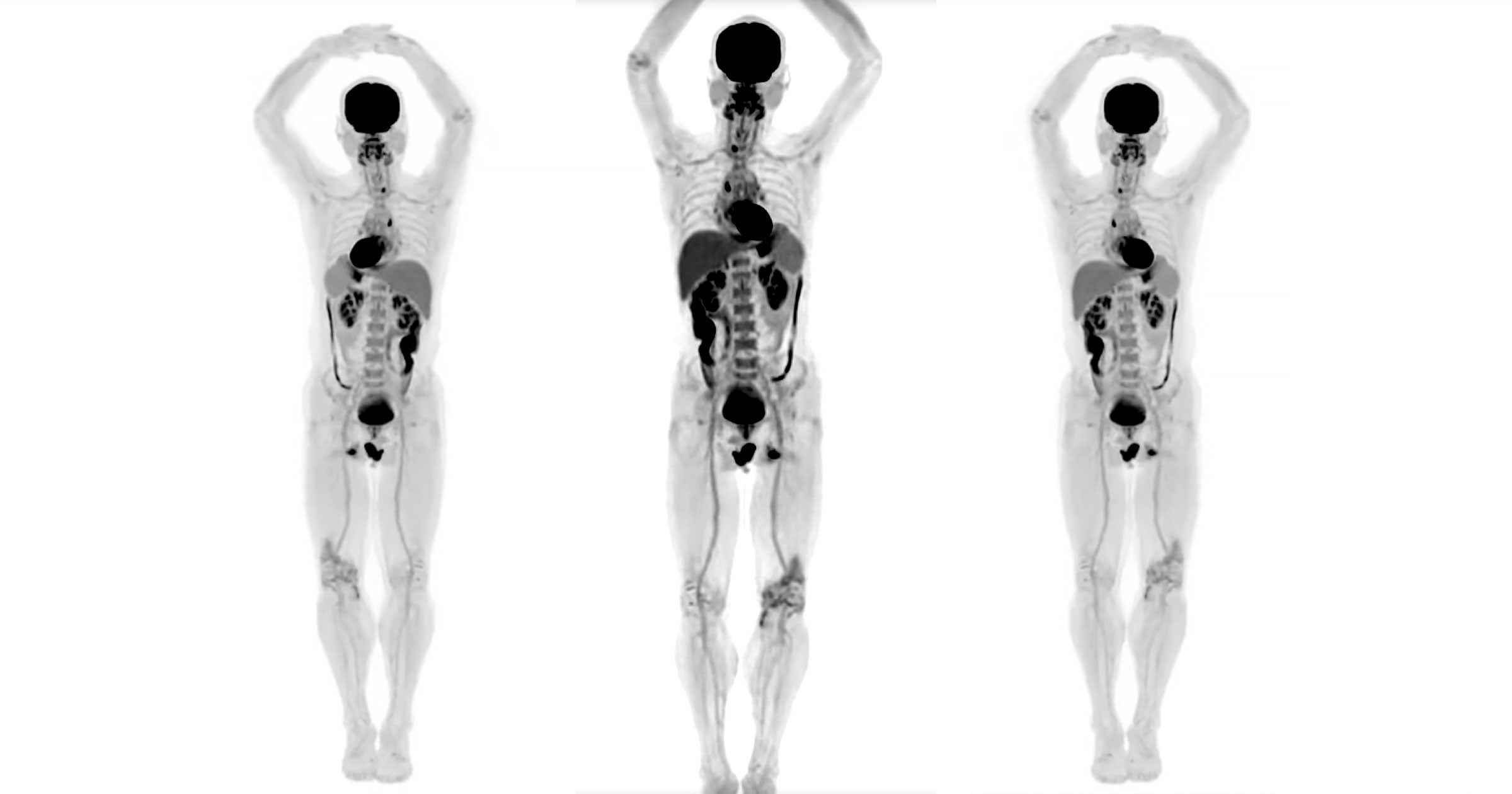 Researchers from UC David have released the first images produced by EXPLORER, a medical scanner that images the whole body in 3D.