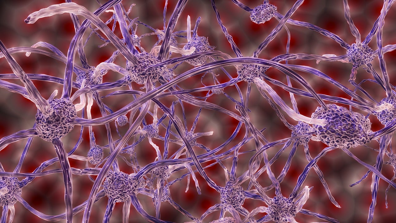 Nerve cells could be rerouted to help prevent phantom limb pain