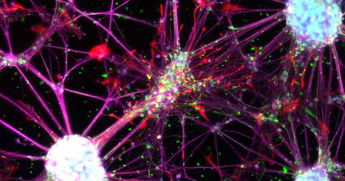 New medical research shows how to reprogram a mature blood cell into a new kind of stem cell that cell can grow into a neuron and multiply indefinitely.