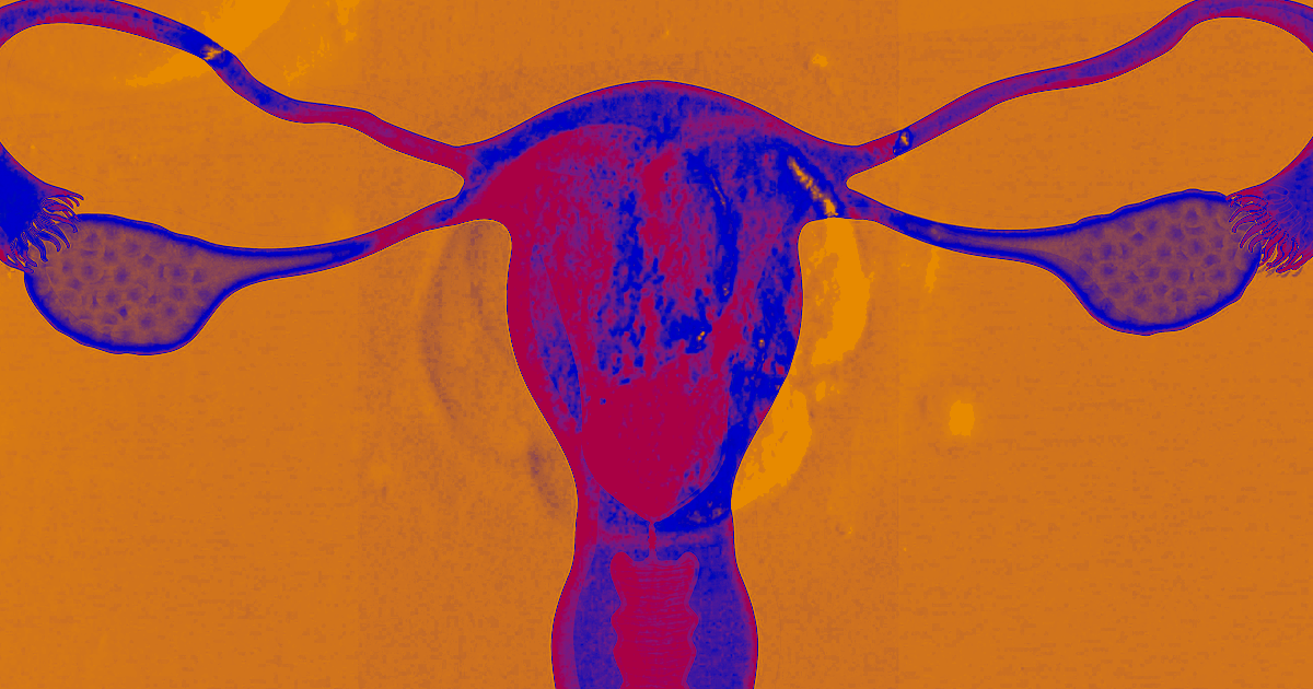 For the first time, an infertile woman has given birth to a healthy baby after receiving a uterus transplant from a deceased person.