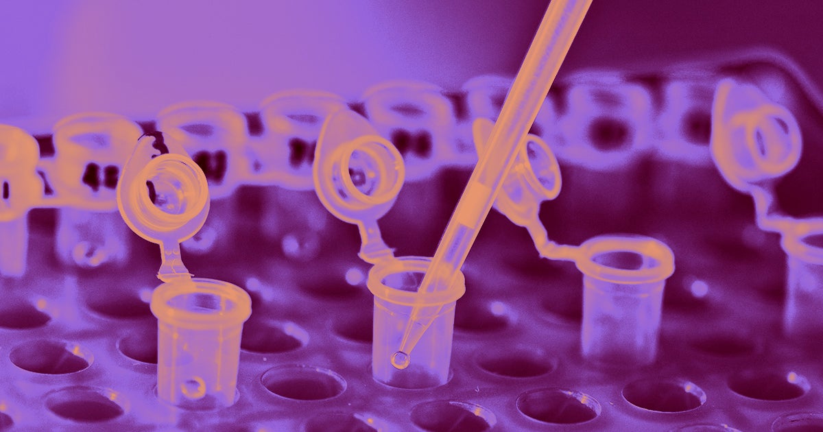 Biotech company Bluebird Bio Inc. wants to sell its genetic replacement therapy for beta thalessemia over a five-year subscription model.
