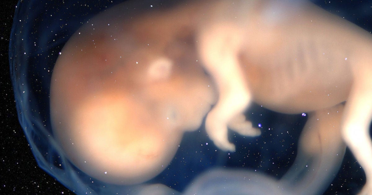 The first off-world baby could be born as soon as 2024.