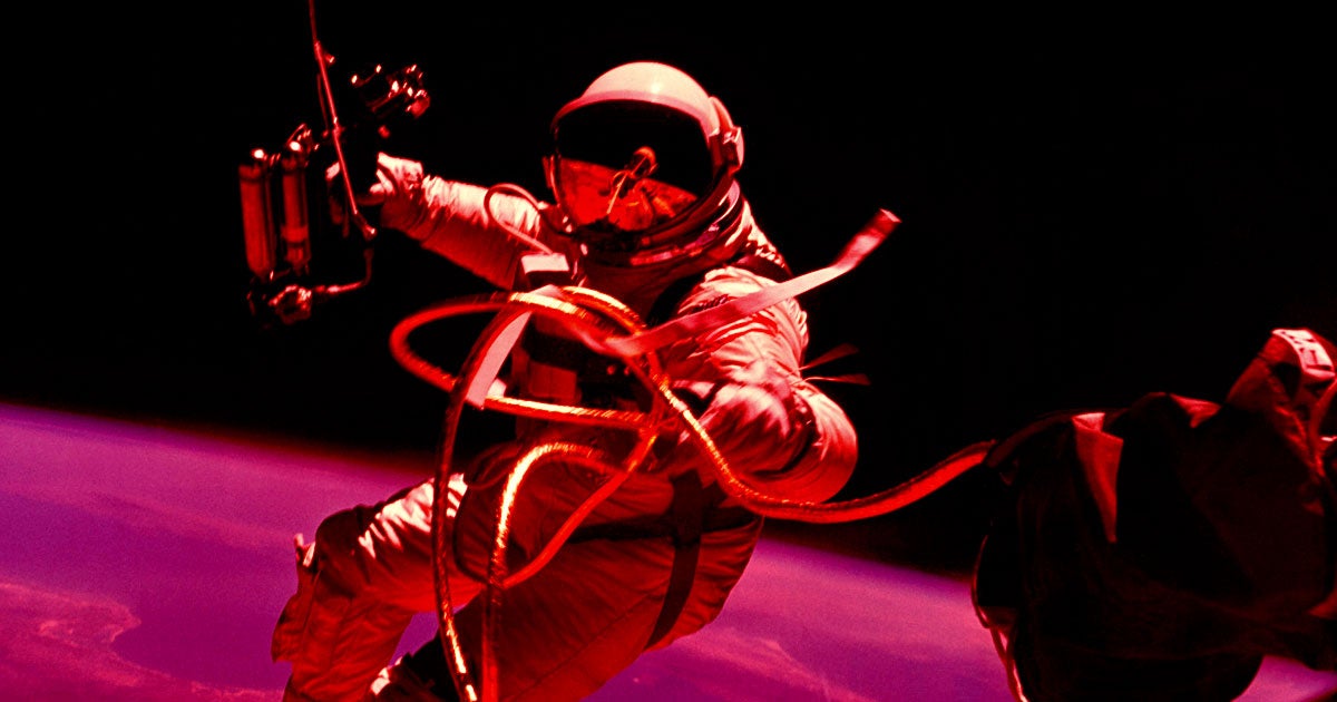 A new study found that spaceflight was associated with changes in the brain's white matter, causing it to age faster. But consequences are still unknown.