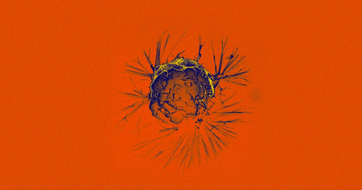 Researchers have discovered what they're calling the cancer "cell of origin," a type of stem cell that leads to the growth of all cancers.