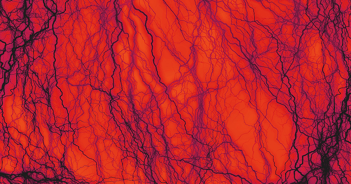 Using cells they harvested from cadavers, researchers grew scaffolds that became blood vessels when transplanted into patients.
