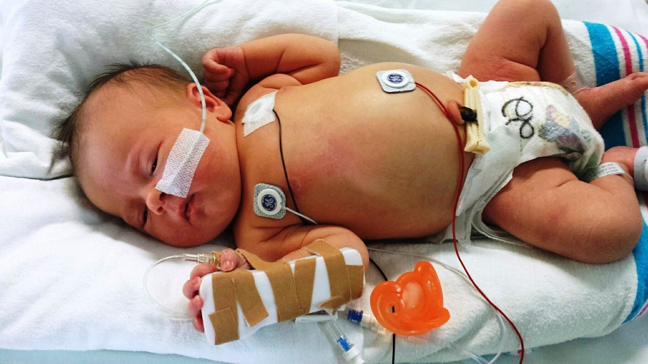 Newborn baby in a hospital bed, machine-learning models can help detect sepsis in babies.