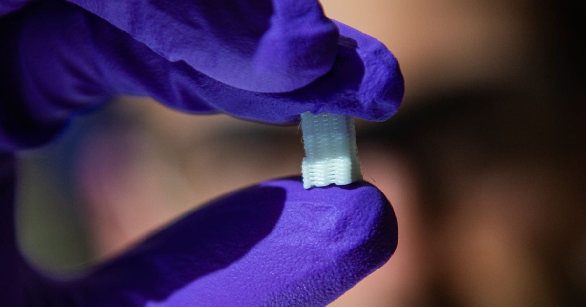 Researchers have 3D-printed tissues to replicate the bone and cartilage most often injured through sports — and their creation could save athletes' careers.