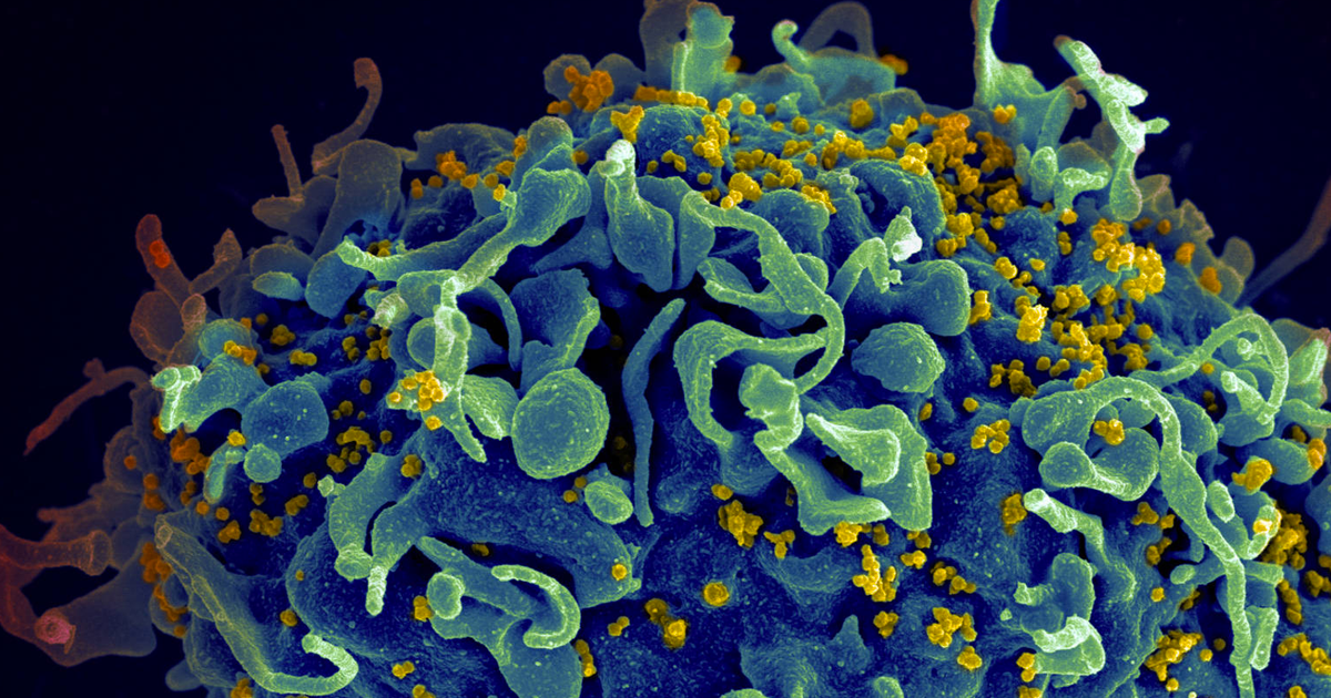 A third patient appears HIV-free following the same time of bone marrow transplant used to treat two others reportedly cured of the virus.