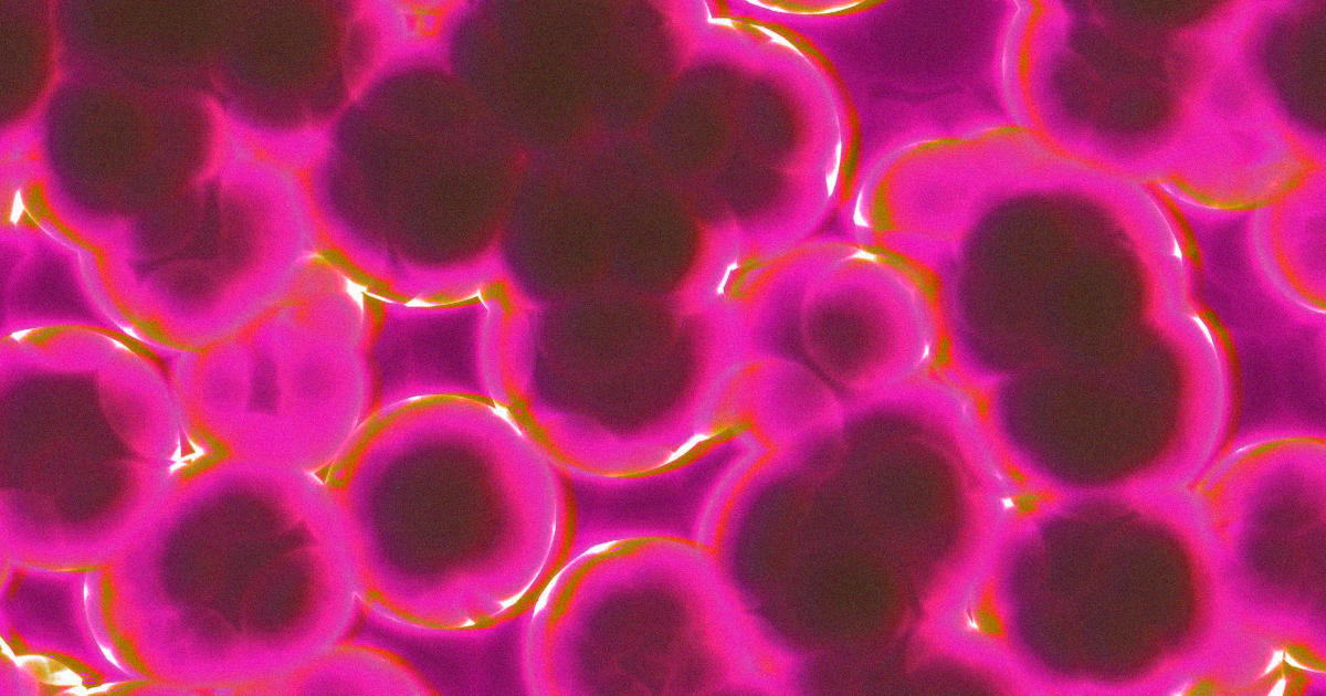 A "super fungus" called Candida auris is cropping up in hospitals all across the globe, killing half the people who contract it within 90 days.