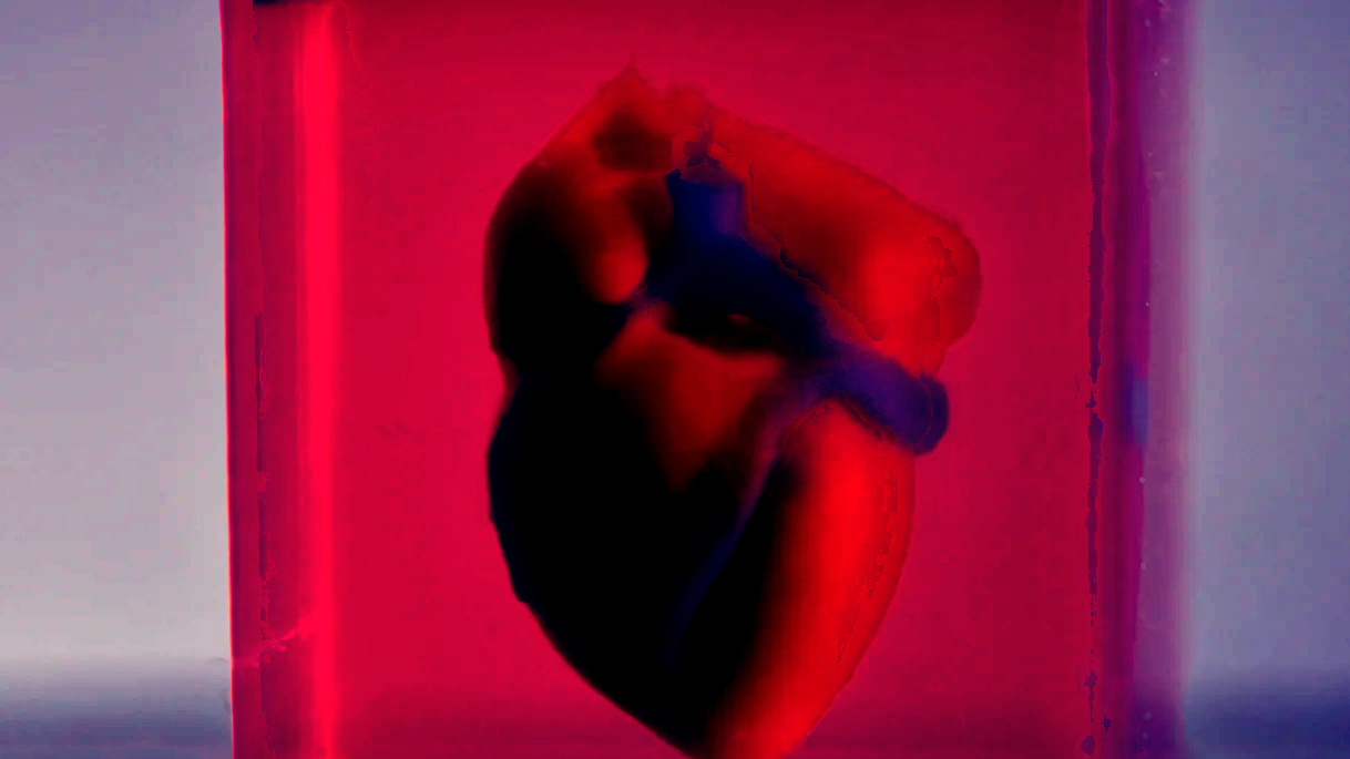 Scientists at Tel Aviv University have created 3D printed "cardiac patches" and a small heart that includes vessels, collagen, and biological molecules.