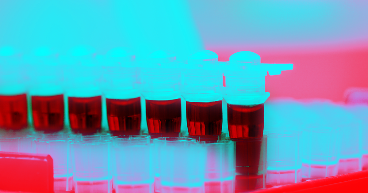 A new study figured out how young blood seems to revitalize older neurons. Two proteins from newborn mouse blood revitalized lab-grown human neurons.