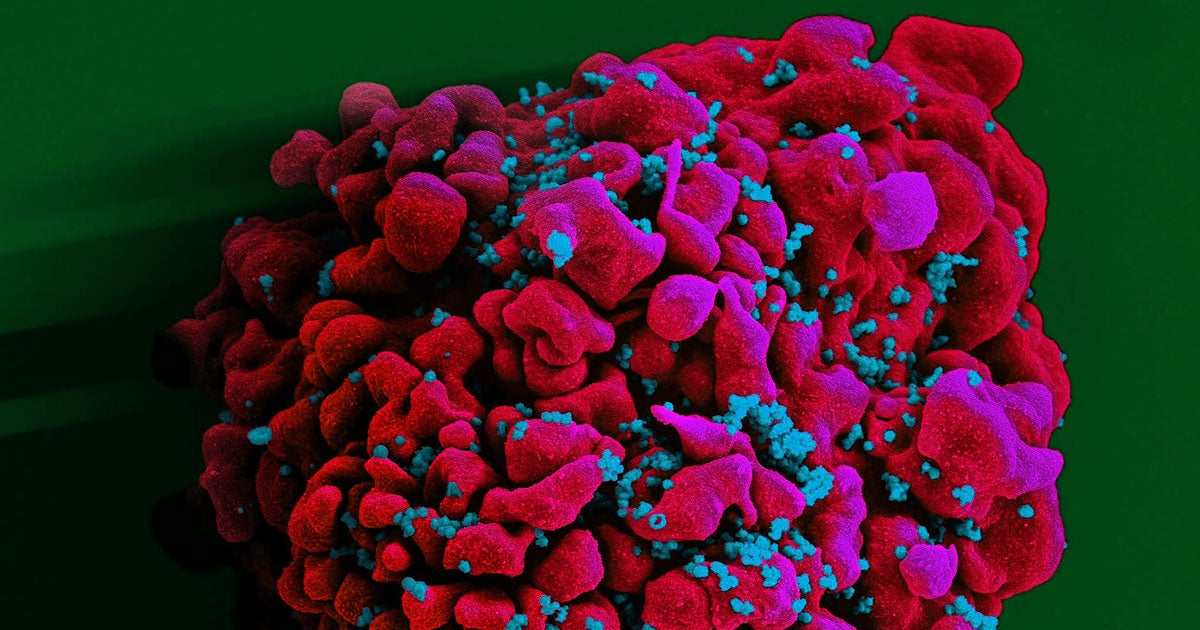 Using a combination of CRISPR and antiretroviral therapy, researcher eliminated the HIV virus from the genomes of mice engineered to produce human T cells.