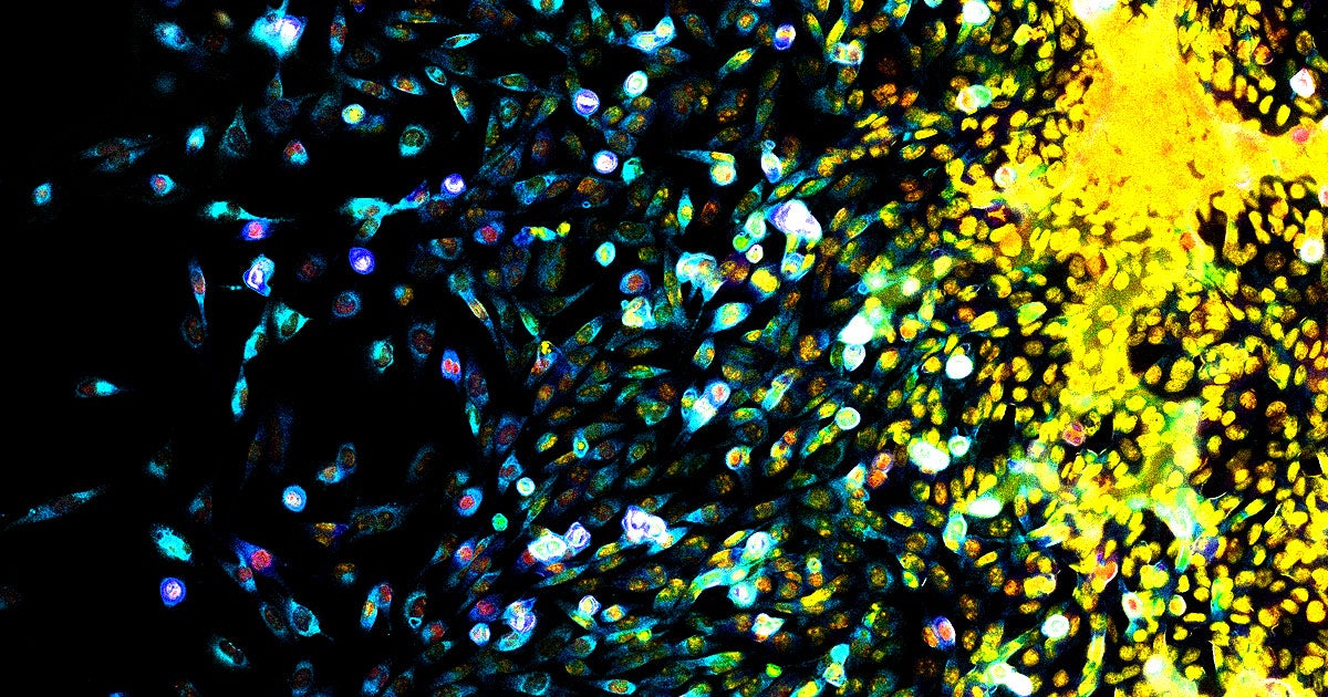 IBM just announced that it was making three of its artificial intelligence projects designed to help doctors and cancer researchers open-source.