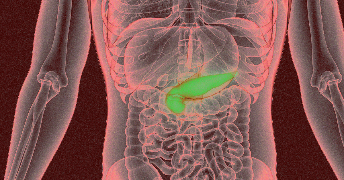 Fed up with the challenges of living with diabetes, a biohacker built himself an artificial pancreas to automatically manage his insulin pump.