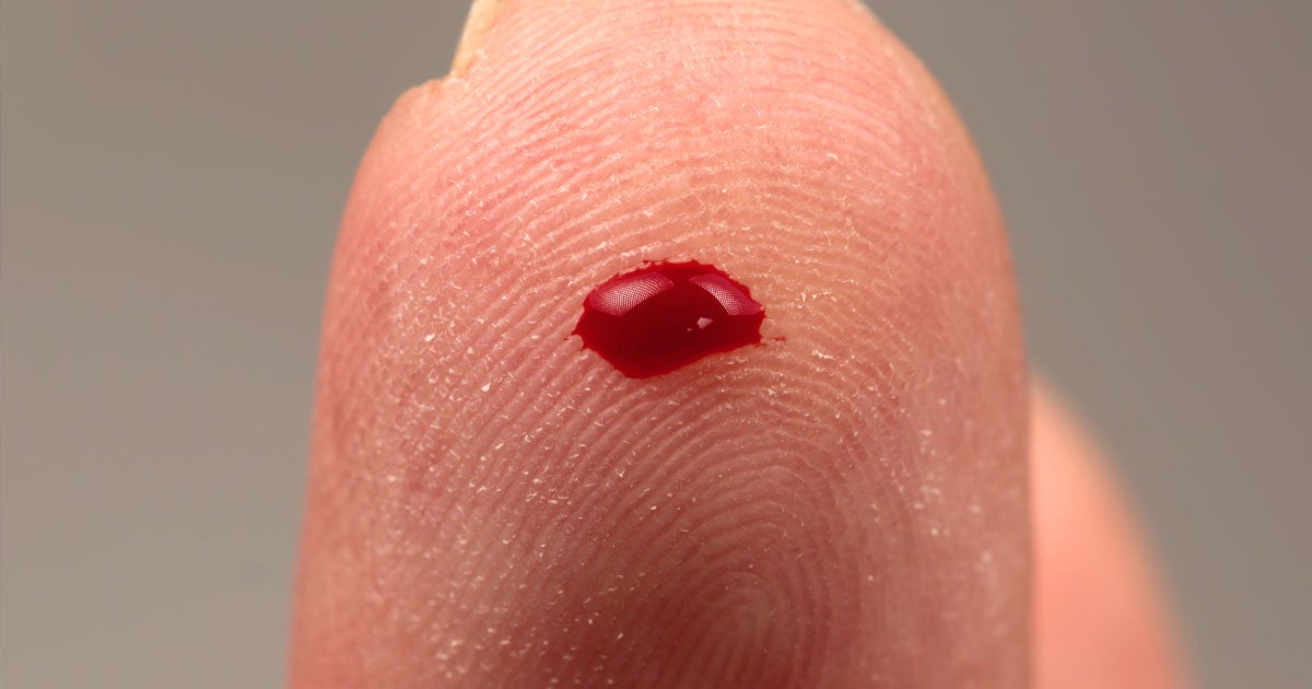 A new blood test that looks at just 14 biomarkers could one day allow doctors to predict the likelihood you're going to die within five to 10 years.