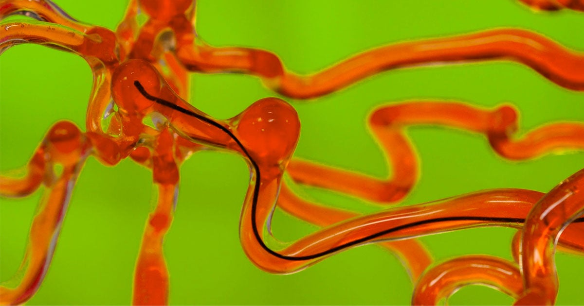 A team of researchers from at MIT have invented a tiny robotic worm that could be steered through the tiny arteries in the human brain using a magnet.