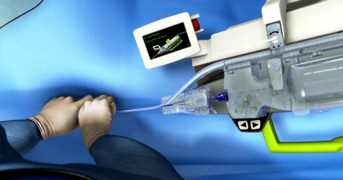 An Indian doctor used a remotely controlled robot to perform heart surgery on five patients while he was 20 miles away from the operating table.