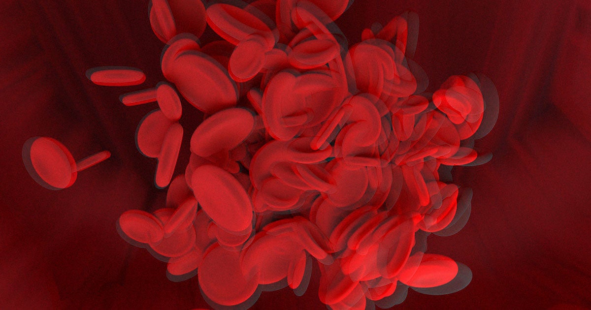 A team of Japanese scientists have created artificial blood that can be used in any patient, regardless of their blood type.