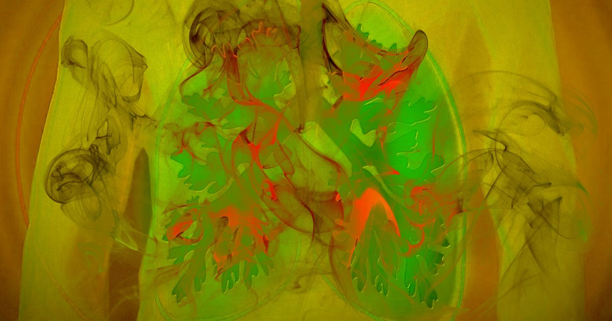 One man recently got a double lung transplant because he vaped so much that he caused irreparable damage to his respiratory system.