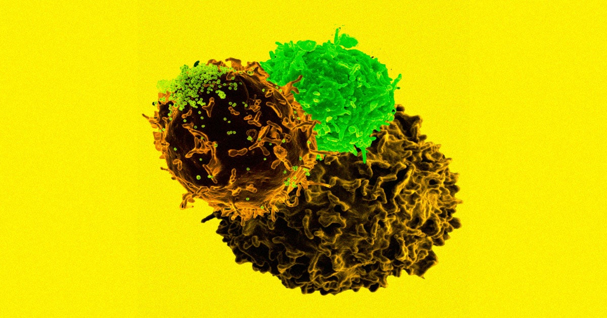 Researchers say they've determined a new cancer treatment that uses CRISPR to gene edit cells is safe and could be effective.