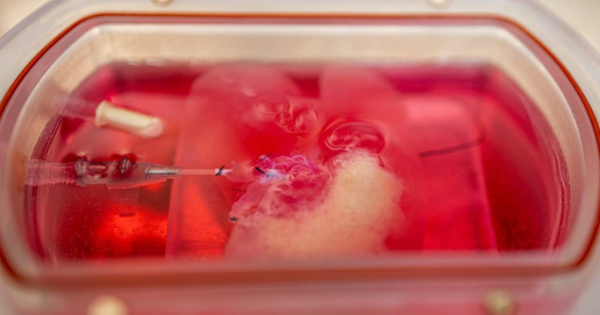 A team of Brazilian researchers have succesfully bioprinted tiny organoids like a mini-liver that perform all of the human liver's functions.