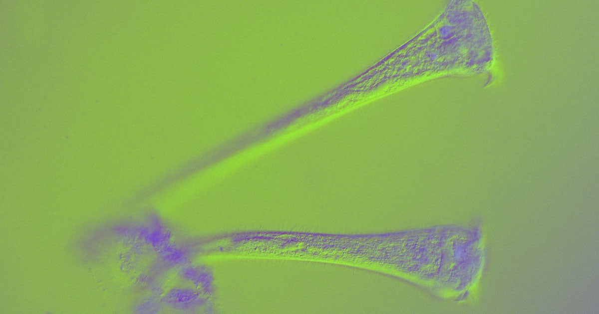 Scientists observed surprisingly complex behavior from a single-celled organism that strongly resembles active decisionmaking.
