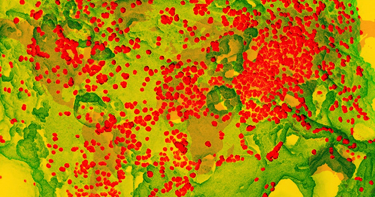 The 2019-nCoV pandemic that began as a viral outbreak in Wuhan, China has rapidly spread to new countries. Here's how it progressed over time.