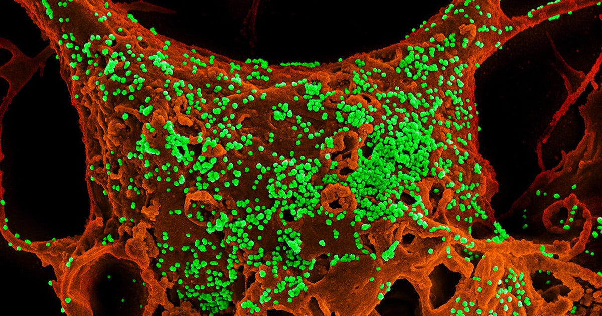 Chinese officials confirmed that the pneumonia-like virus that first emerged at a Wuhan seafood market can be transmitted from person-to-person.