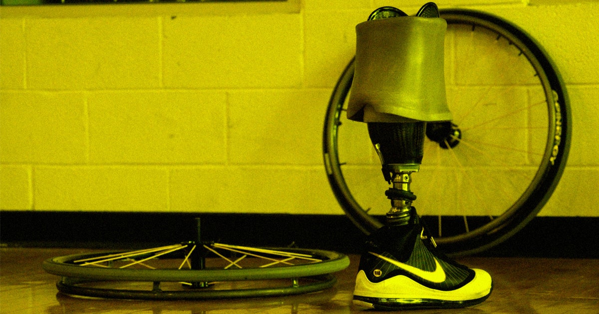 When the Department of Veterans Affairs refused to pay for a disabled veteran's prosthetic legs, the company that provided the limbs came to repo them.