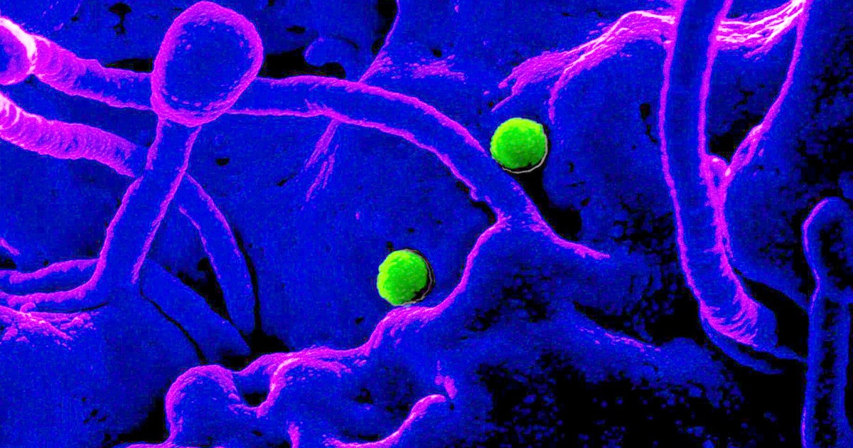 The mysterious Chinese pneumonia-like coronavirus that originated from Wuhan, China, has officially reached the US, with one confirmed case in Washington.