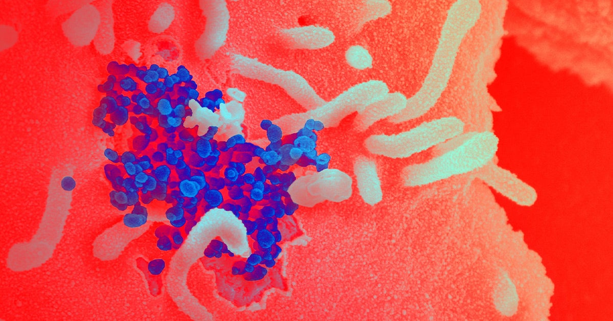 A new report by researchers at Imperial College London in the UK suggest that about two thirds of new COVID-19 coronavirus infections have gone undetected.