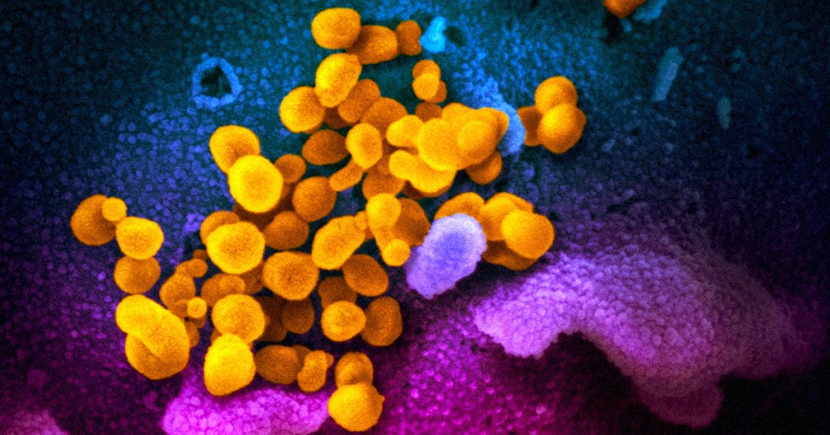 American doctors are worried that the COVID-19 epidemic could lead to a crisis as patients overwhelm emergency rules and exhaust stores of medical supplies.