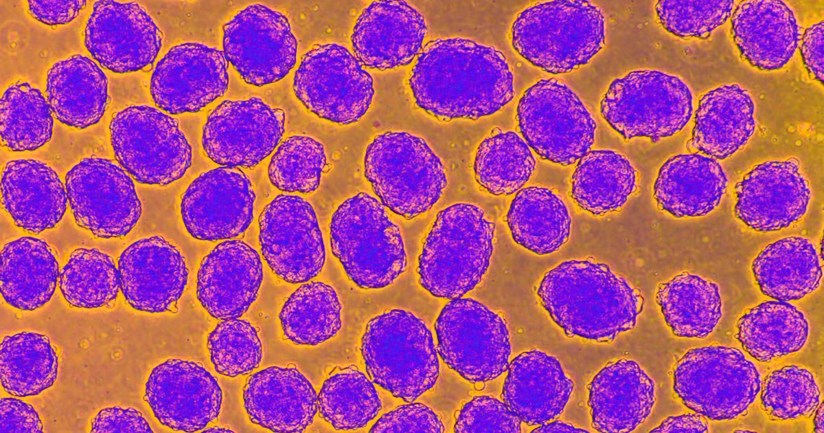 Special modified human stem cells were able to control blood sugar levels in a demonstration involving diabetic mice by secreting insulin.