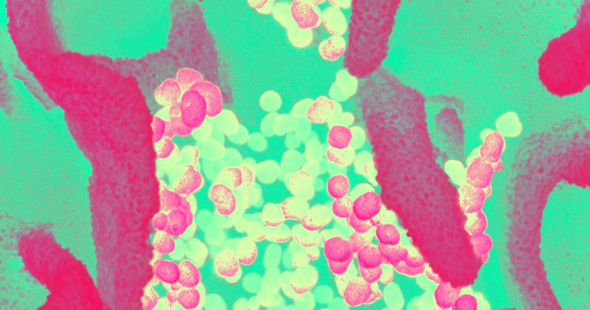 The French Health Ministry announced that France no longer has confirmed cases of the coronavirus COVID-19: one patient died but all the others recovered.
