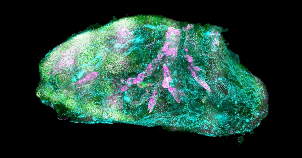 A research team's new technique has improved the development of transparent organs creating stunning images of 3D cellular maps.