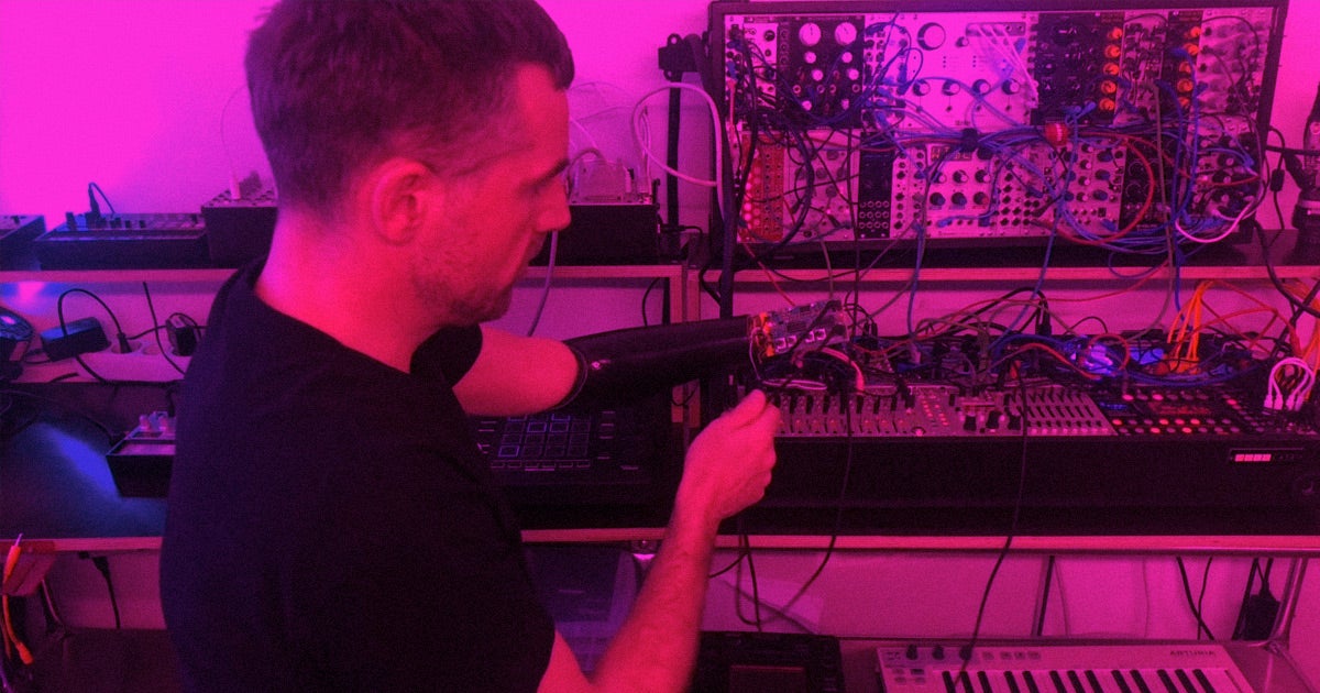 This German a way to hack his prosthetic arm so that it could control electronic musical instruments.