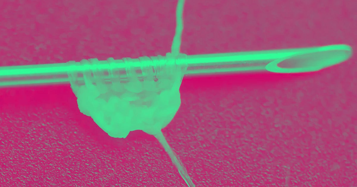 A team of French researchers have grown yarn from human skin cells that could be used by surgeons as simple sutures or assembled into skin grafts.