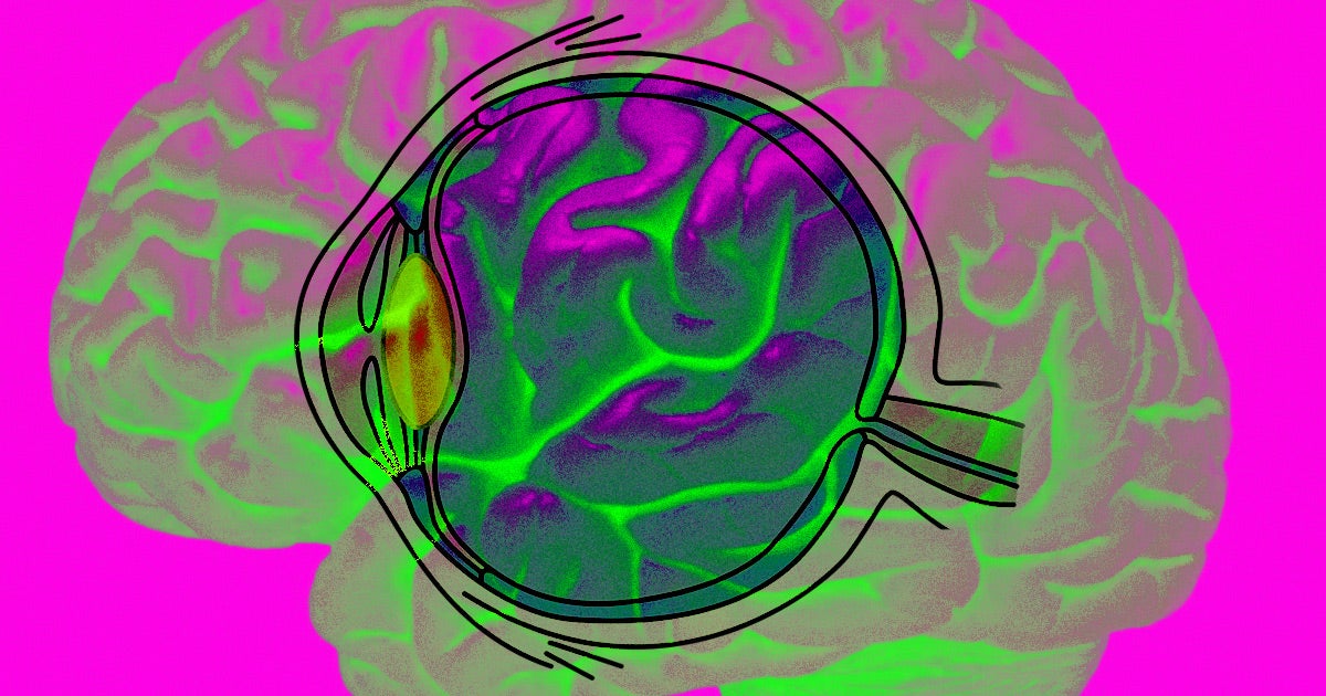 Using a bionic eye developed by Spanish neuroengineer Eduardo Fernandez, a blind woman was able to see for the first time in 16 years.
