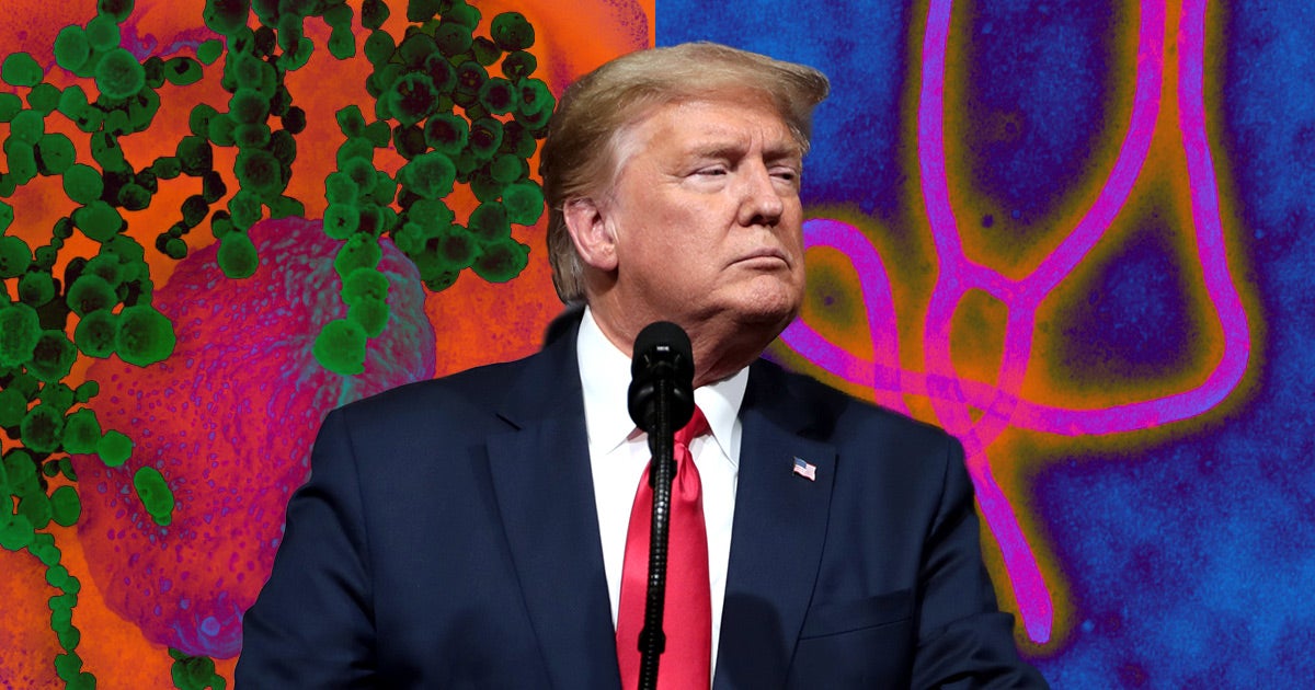U.S. President Donald Trump appeared to confuse the coronavirus SARS-CoV-2 with Ebola, a completely separate deadly disease.